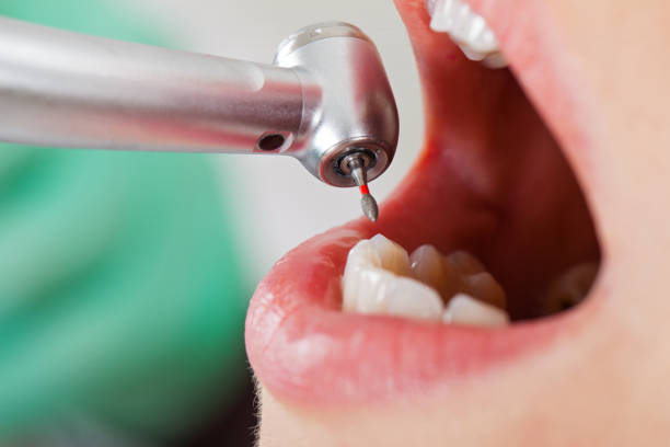 Best Cosmetic Emergency Dentistry in Catonsville, MD